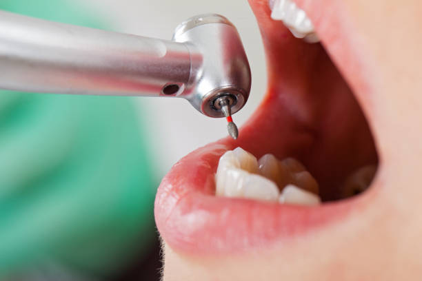 Best Emergency Treatment for Oral Infections in Nazareth College, NY
